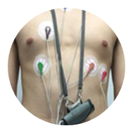 ECG Holter